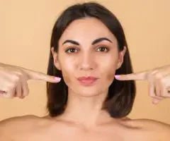 Fat Transfer to Cheeks