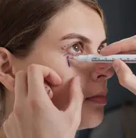 Under Eye Nano-Fat Grafting
