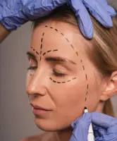 Face Lift